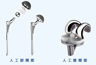 人工関節置換術 MIS