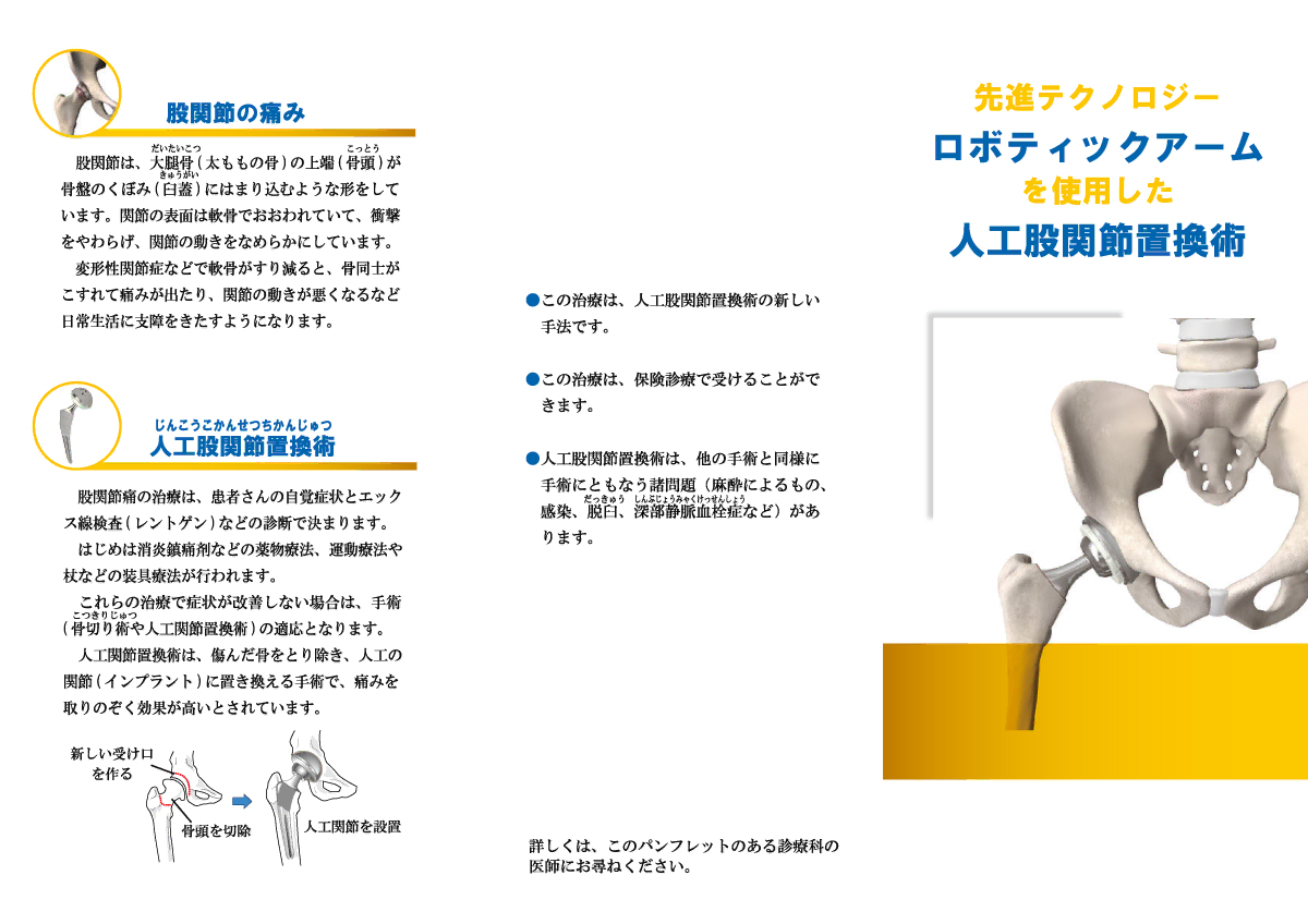 先進テクノロジーロボティックアームを使用した「人工股関節置換術」