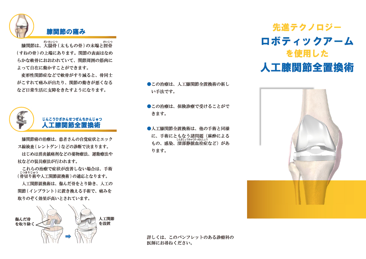 先進テクノロジーロボティックアームを使用した「人工膝関節置換術」