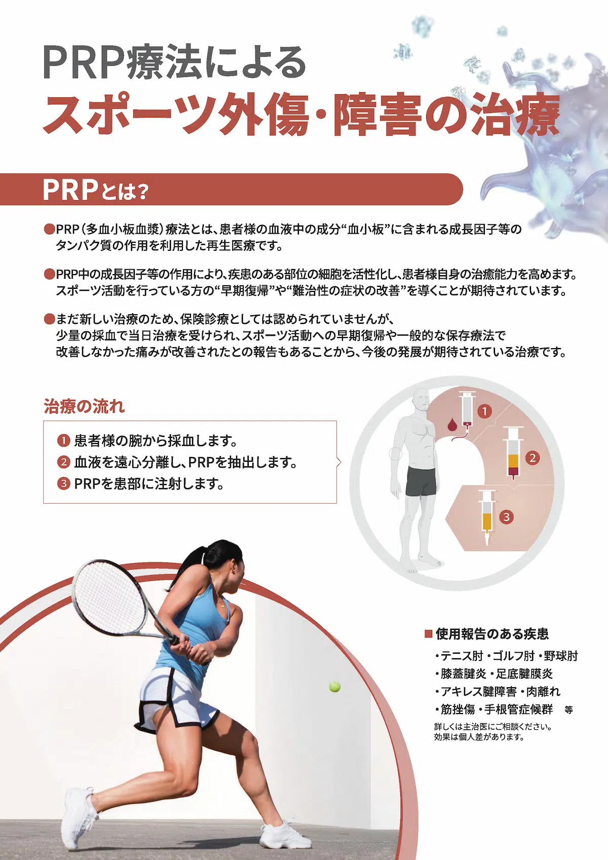 PRP療法によるスポーツ外傷・障害の治療