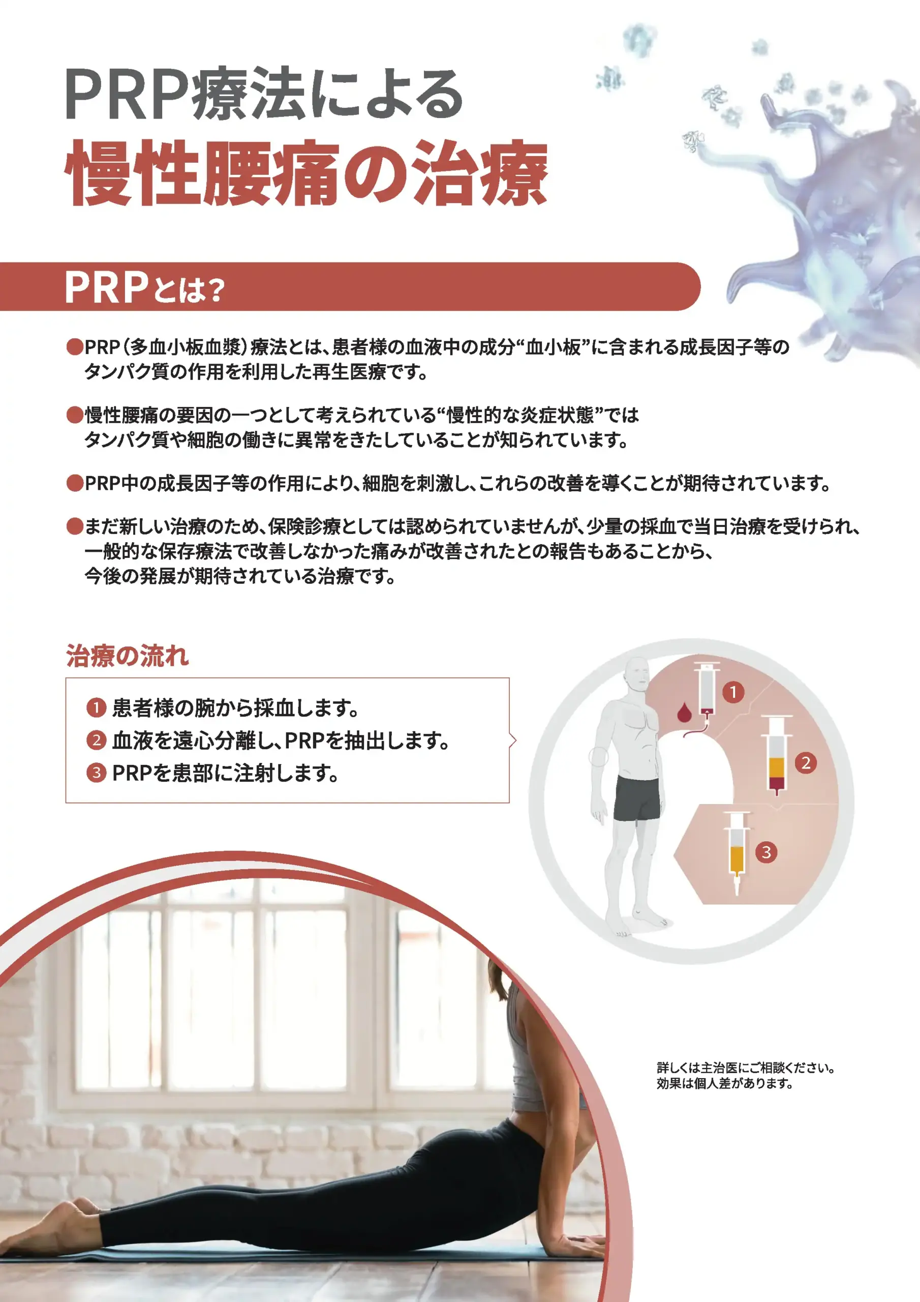 PRP療法による慢性腰痛の治療