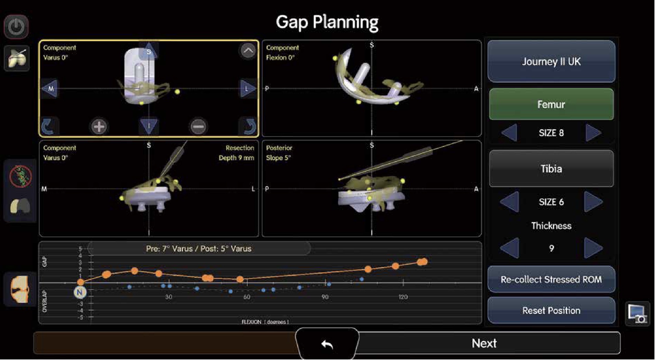 膝関節用ロボティックアーム